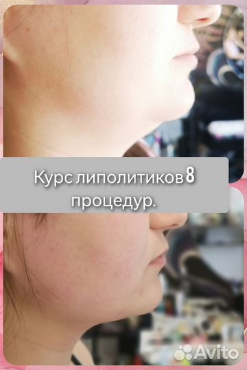 Услуги косметолога