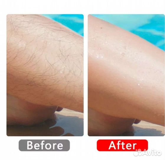 Эпилятор для волос