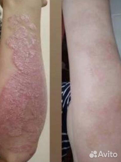 Мазь нафталновая+вода сероедная