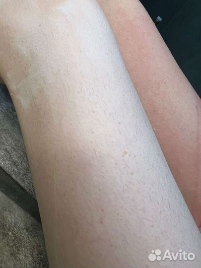 Восковая депиляция