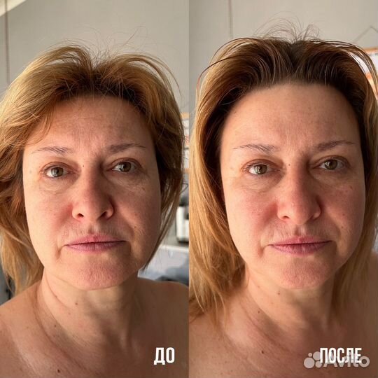 Массаж лица Саки