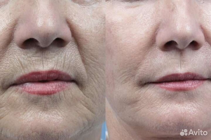 Избавлю вас от лишних -3-12 см )