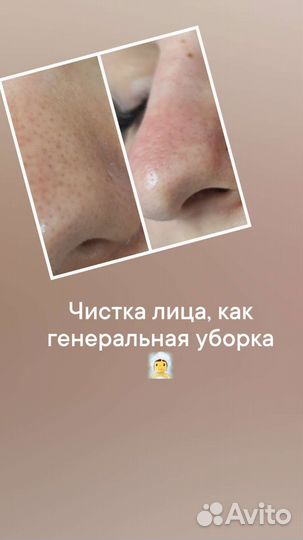 Шугаринг, эстетика лица