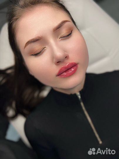 Увеличение губ