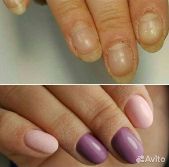 Педикюр, маникюр