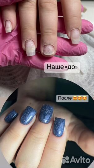 Идеальный маникюр,Медицинский педикюр, подолог