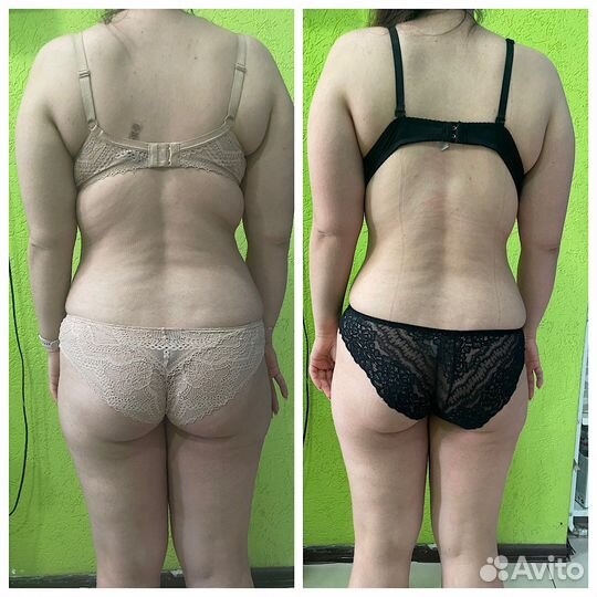 Lpg массаж, услуги по коррекции фигуры и лица