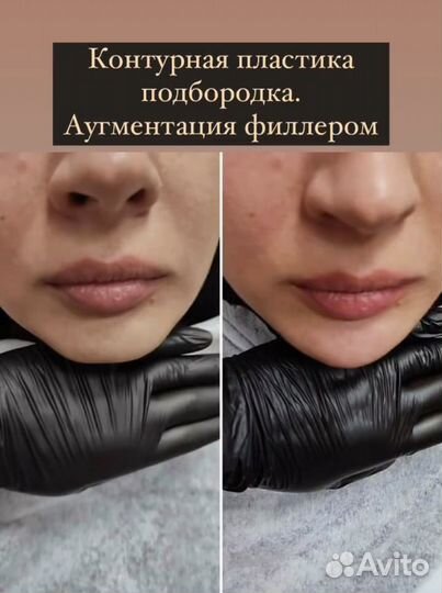 Ресницы, косметология, перманент