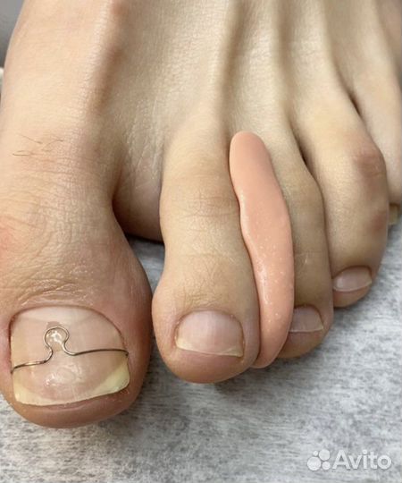 Педикюр подолог