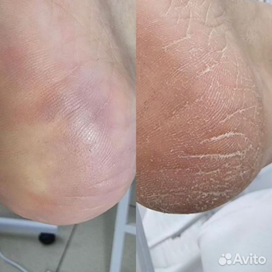 Педикюр маникюр