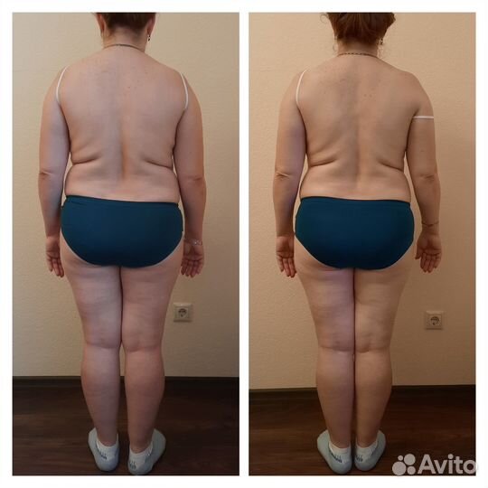 Массаж коррекция фигуры