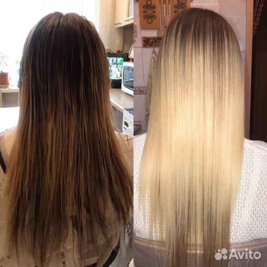 Ботокс;Нанопластика; биксипластия;кератин