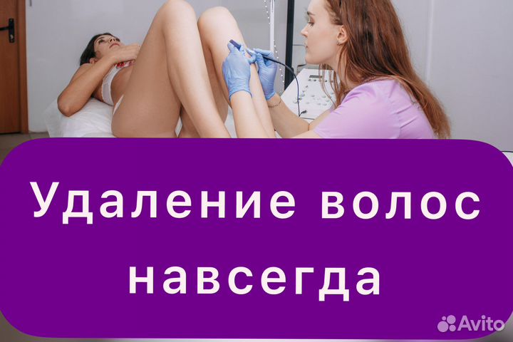 Электроэпиляция