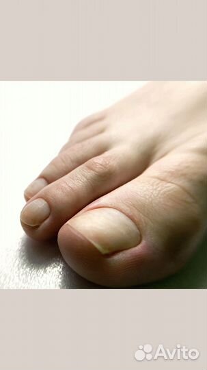 Педикюр ленинский проспект