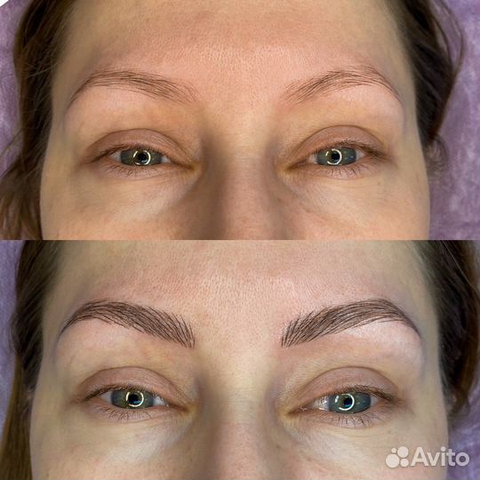 Микроблейдинг