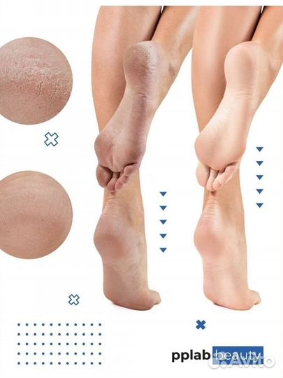 Набор для педикюра