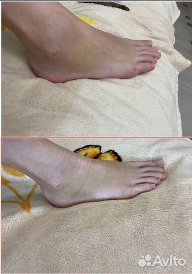 Лечебный массаж скэнар терапия выезд на дом