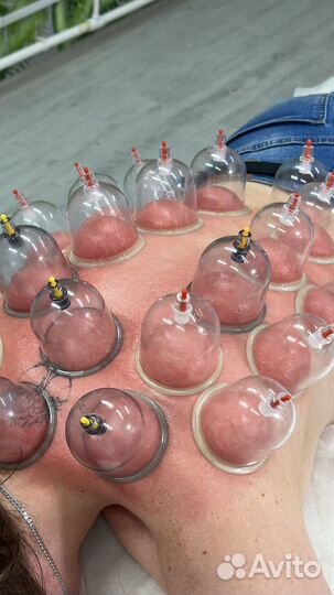 Баночный массаж