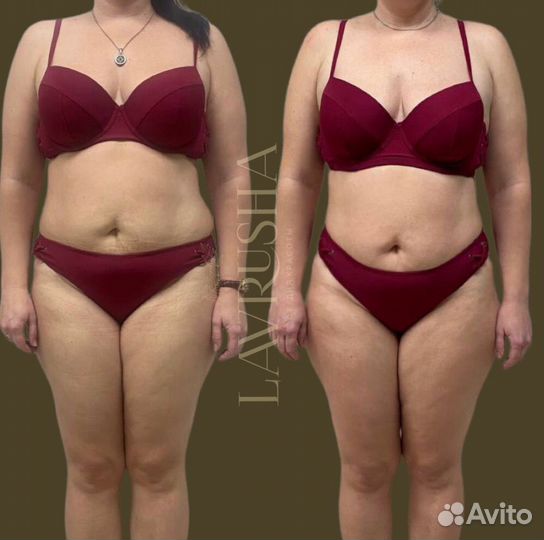 Массаж коррекция фигуры