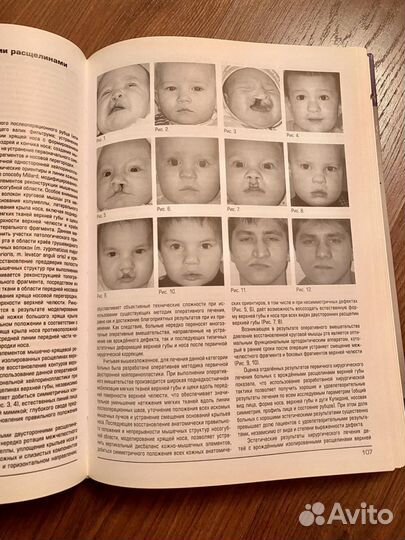 Врожденная и наследственная патология головы