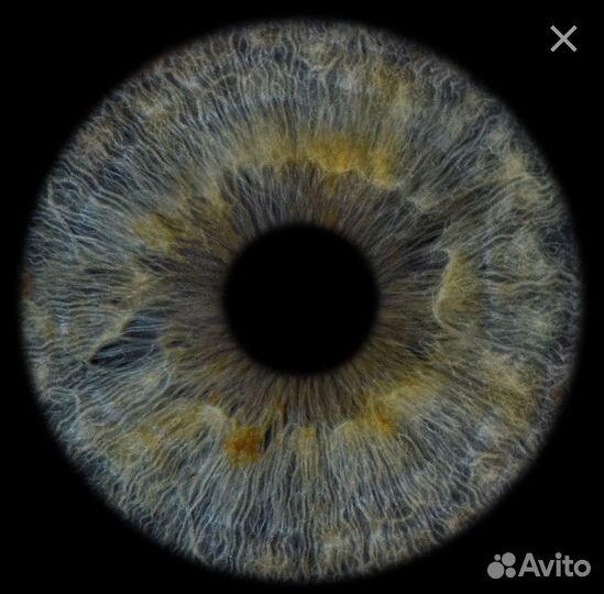 Фото радужки глаза