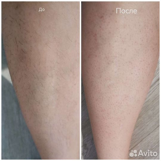 Восковая депиляция