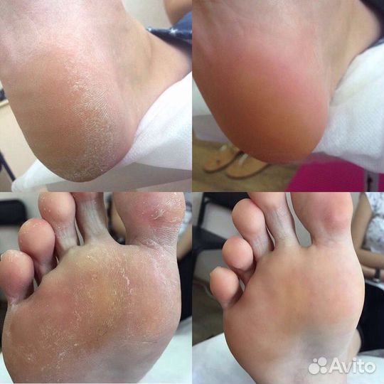 Маникюр, педикюр на дому