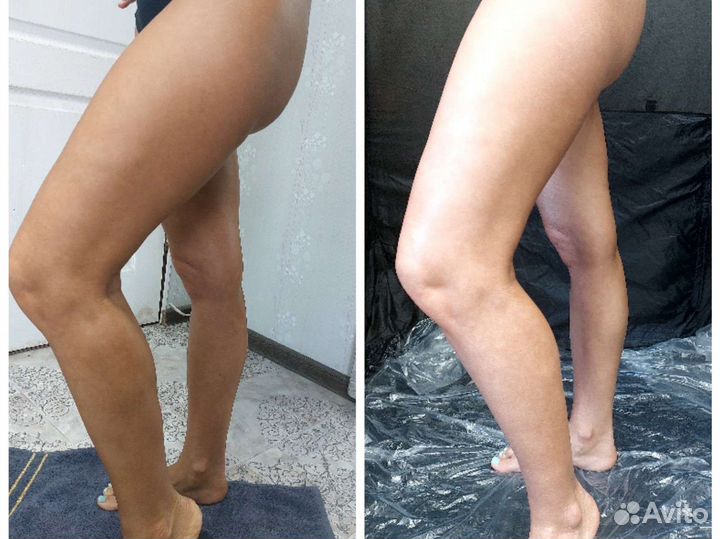 Моментальный загар