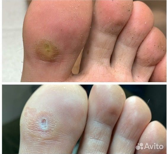 Мастер педикюра подолог