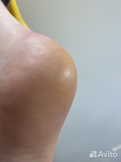 Педикюр подолог титановая нить