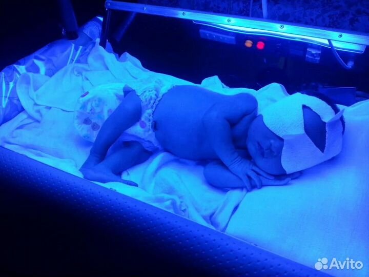 Прокат лампы от желтушки, желтухи новорожденных