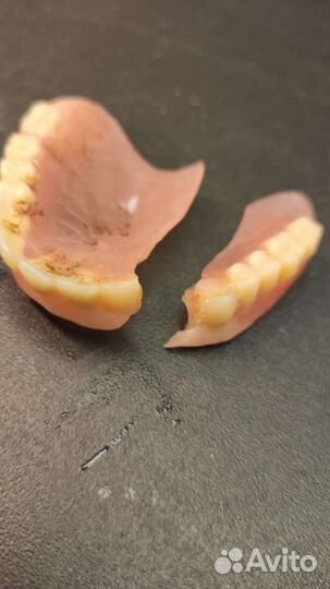 Ремонт зубных протезов