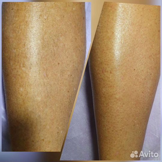 Восковая депиляция(мужская/женская)