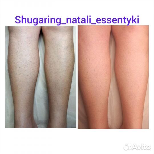 Восковая депиляция