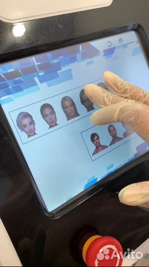 Лазерная эпиляция