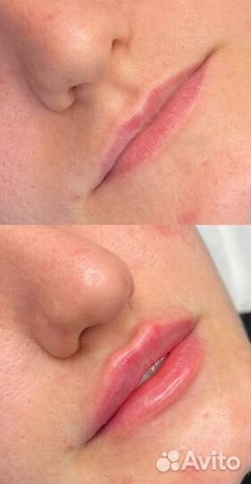 Косметолог с мед. образованием