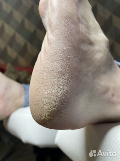 Смарт педикюр