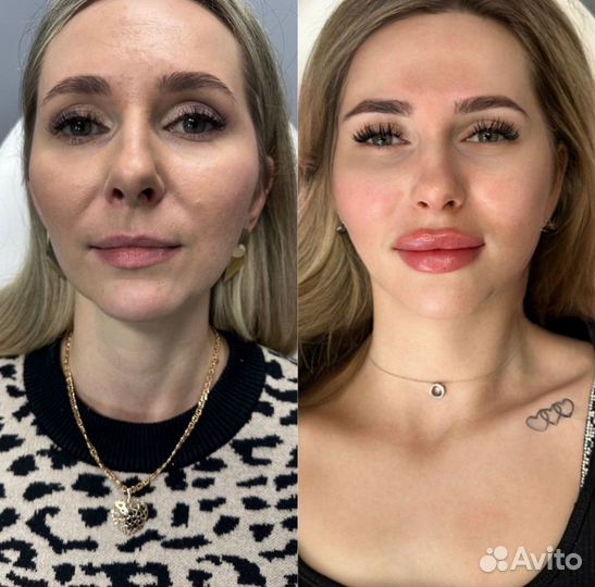 Full Face / Лицо под ключ