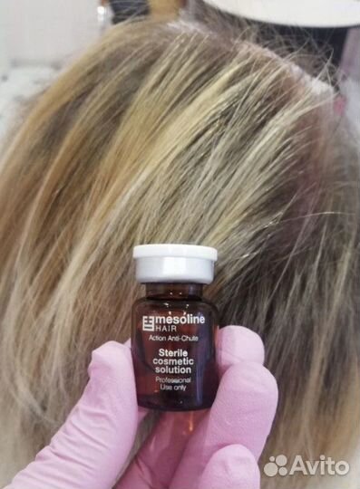 Мезотерапия от выпадения и восстановление волос