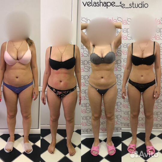 Антицеллюлитный массаж Коррекция фигуры. Похудение