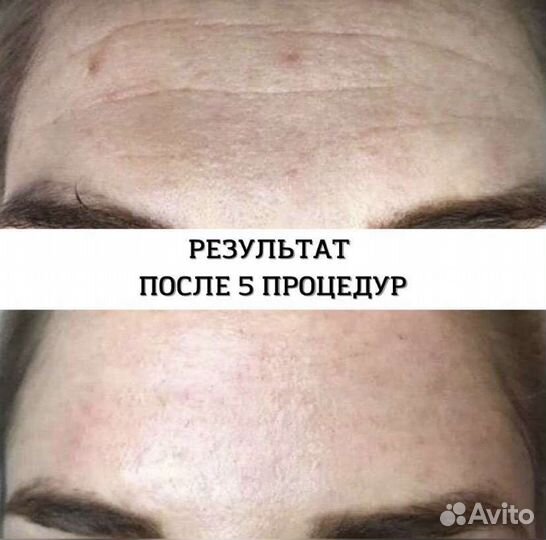 Консультация косметолога
