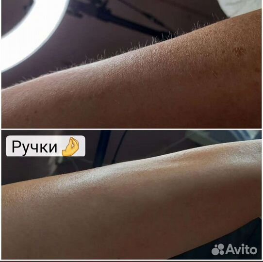 Депиляция/Шугаринг/Воск