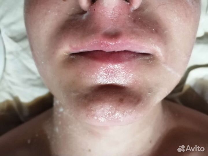 Депиляция воском: глубокое бикини