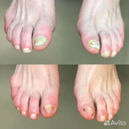 Педикюр(муж./жен),Подология, Смарт-педикюр