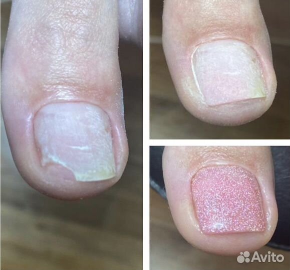 Педикюр + гель-лак