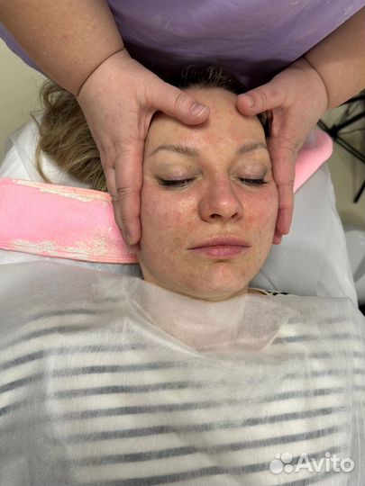 Массаж лица