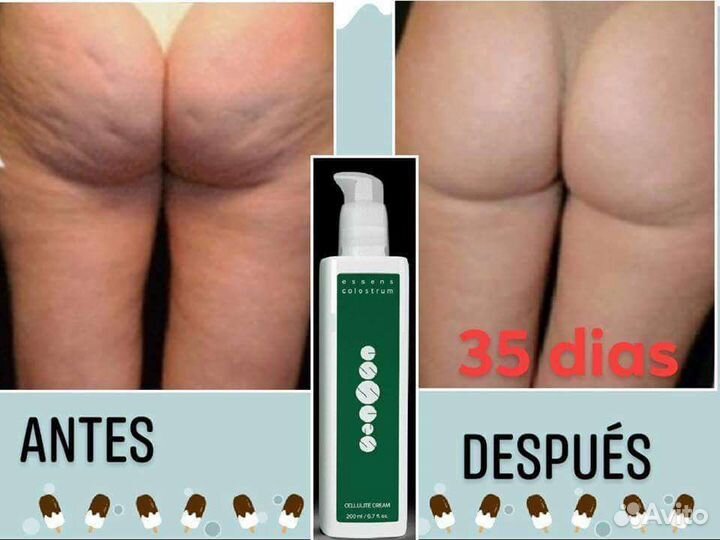 Антицеллюлитный крем