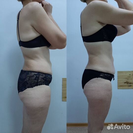 Массаж похудение