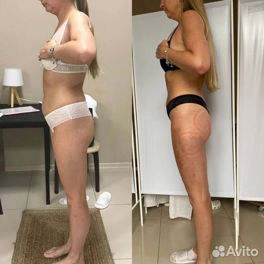 Модель на массаж