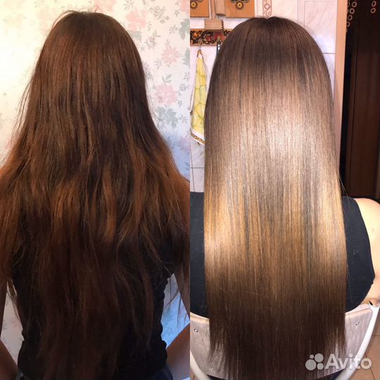 Ботокс;Нанопластика; биксипластия;кератин